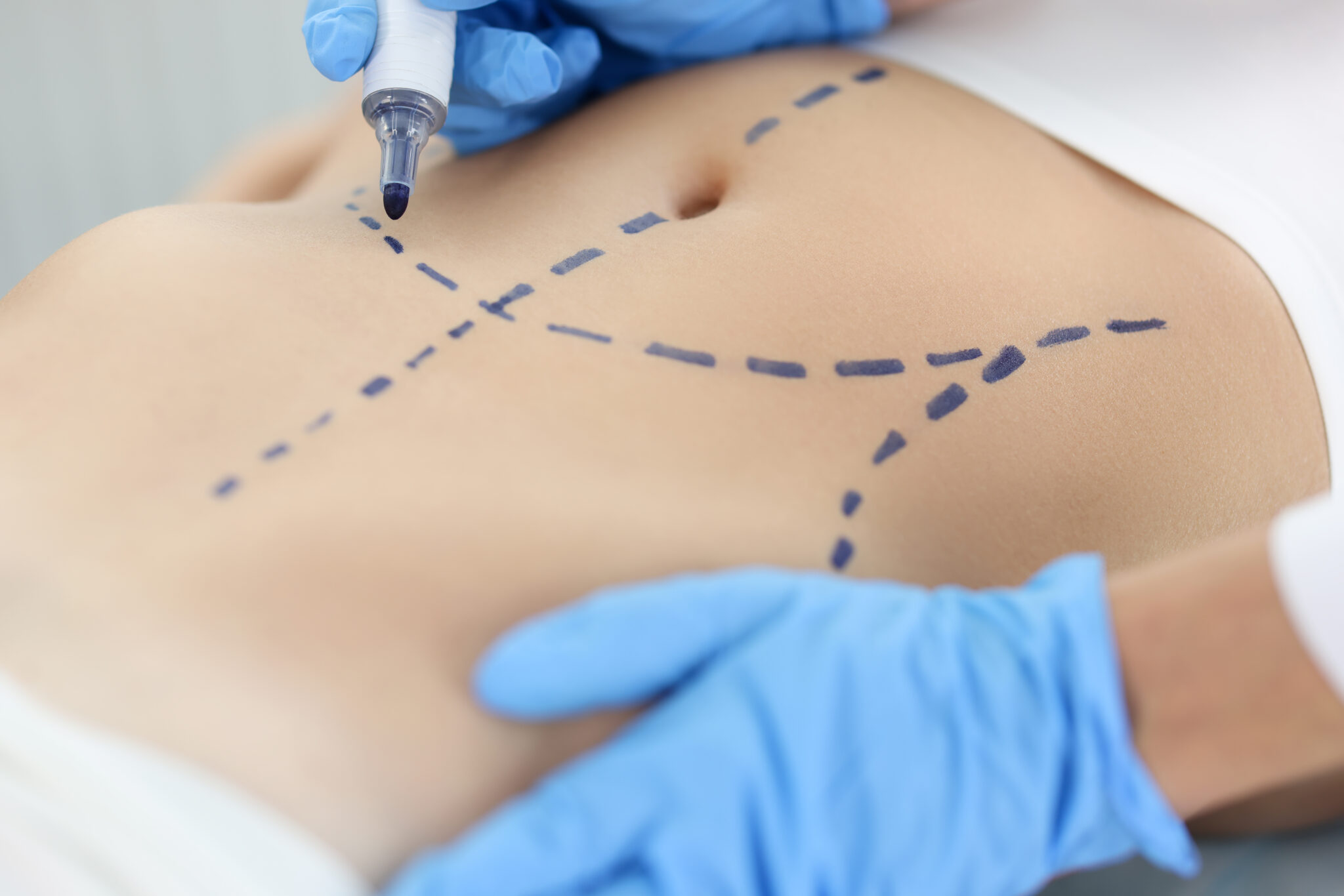 Innere Wundheilung nach OP beschleunigen: Tipps